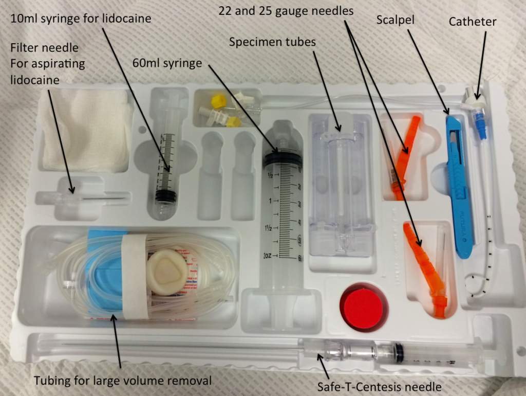 Abdominal Paracentesis