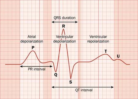 ECG