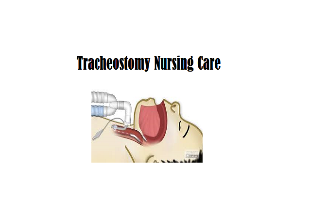 tracheostomy care to a patient, including suctioning and tube cleaning."my Nursing Care